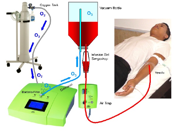 Ozone Generator Tips