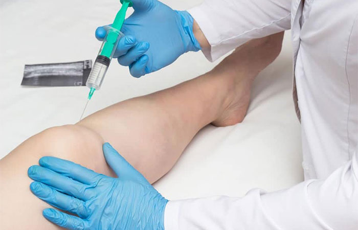Ozone Therapy