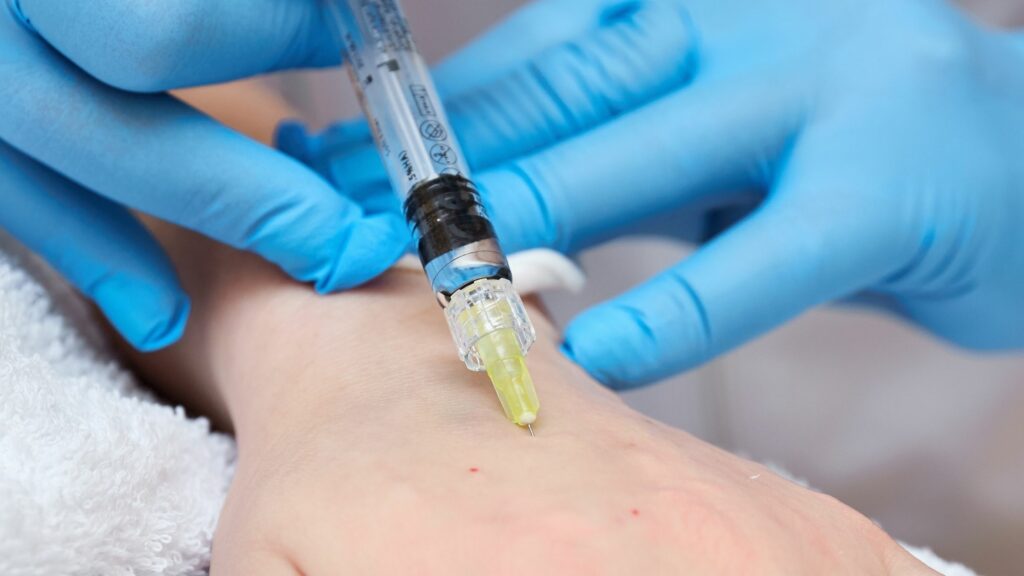 Ozone Injection Therapy